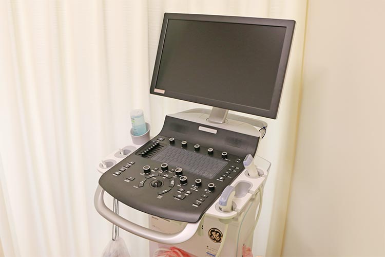 超音波診断装置
